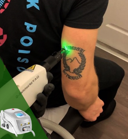 QS laser equipment 2 Лазерное оборудование QS 2