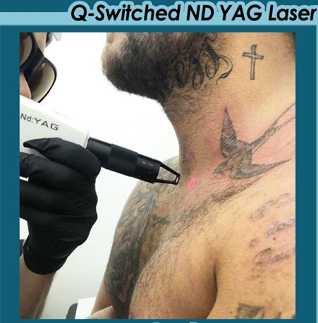 Лазерное оборудование QS 1