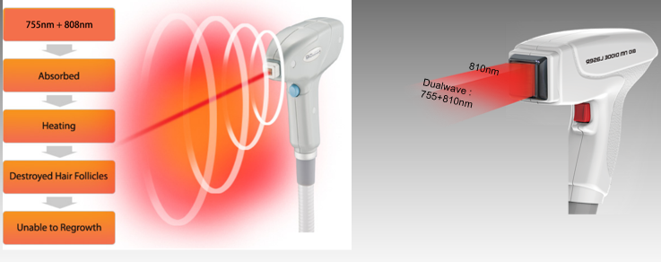 диодное лазерное оборудование