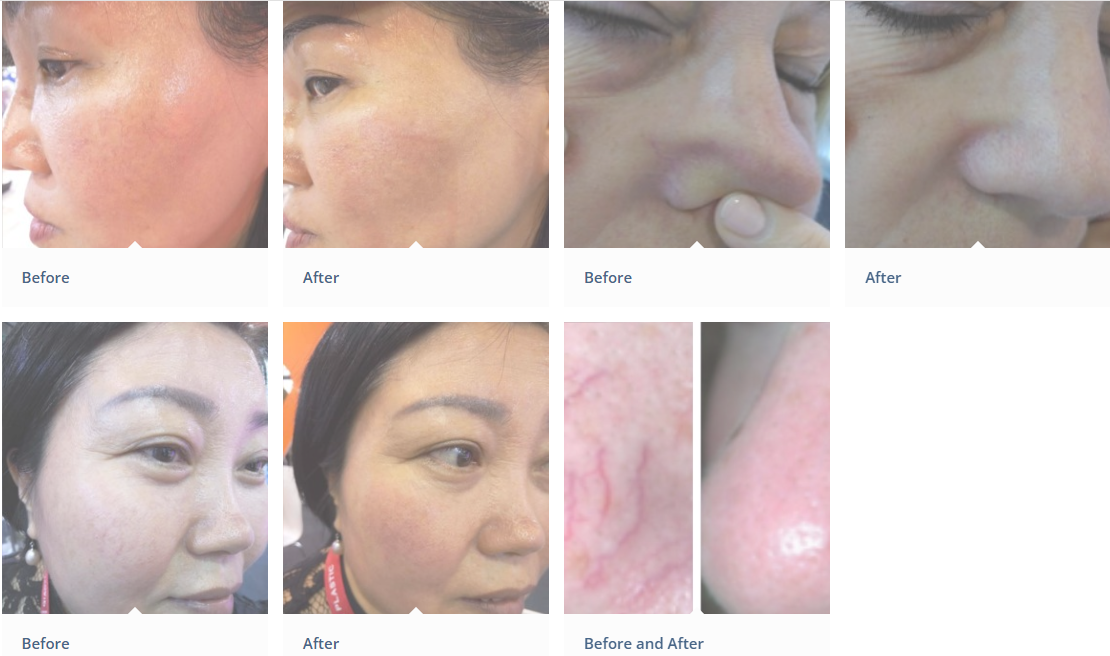 Фото до и после