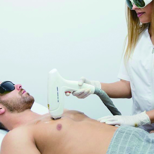 Удаление волос лазер